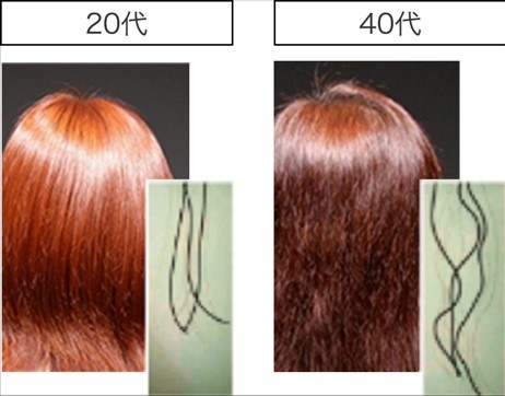 加齢による「うねり」の増加とツヤの低下