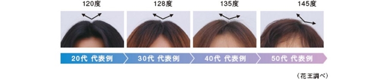 毛量の減少とボリュームの変化について