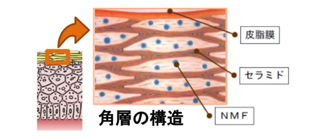 頭皮のトラブルは何故起きる？