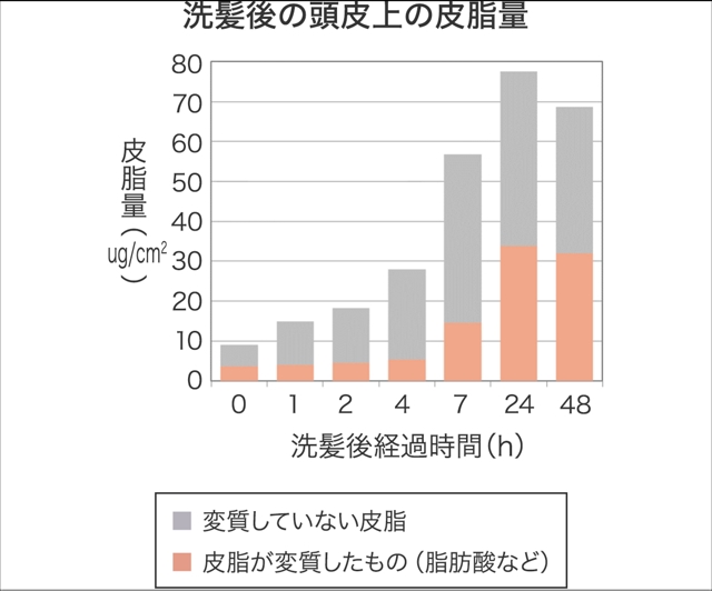 頭皮のトラブルを防ぐには？